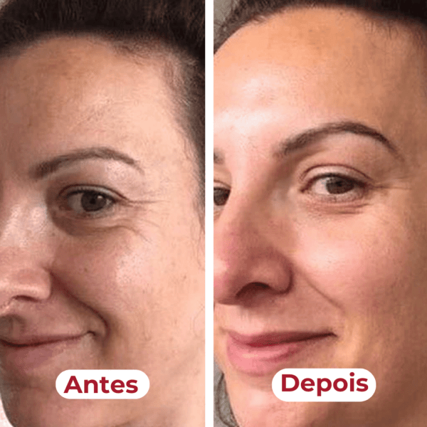 Antes e depois: pele com mais viço e luminosidade
